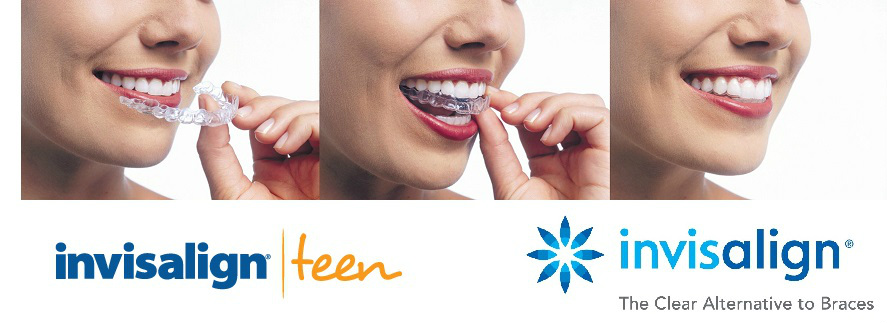Teen Effectively Straightens Teeth 27