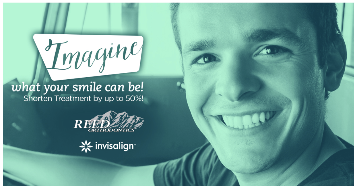 How to Get a Brighter Smile in Less Time with Invisalign